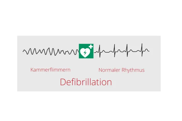 significato defibrillatore